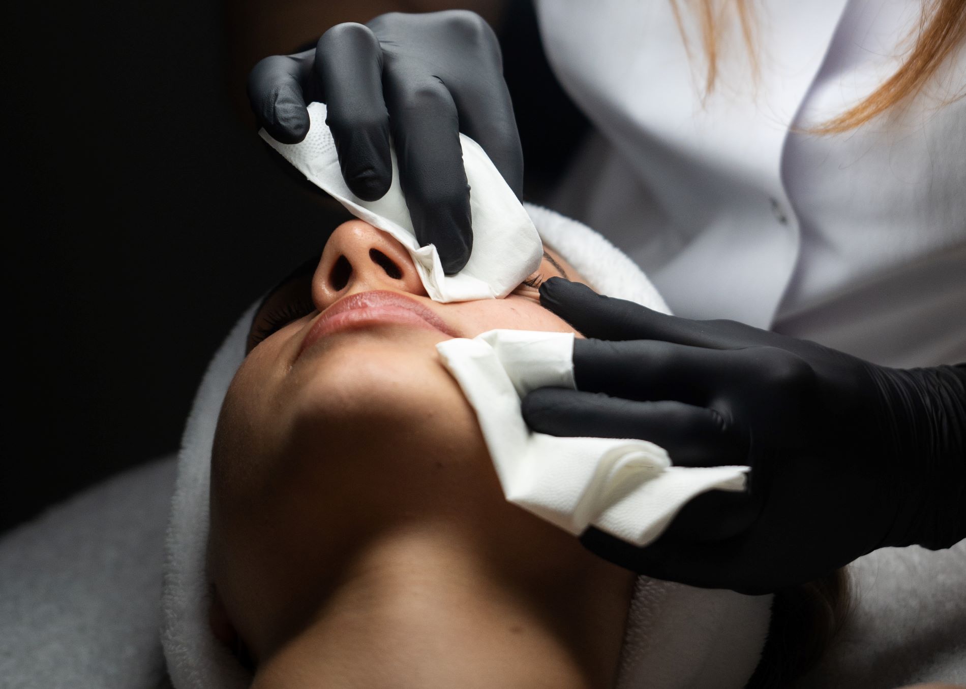 studio-style-problematicna-koza-akne-003