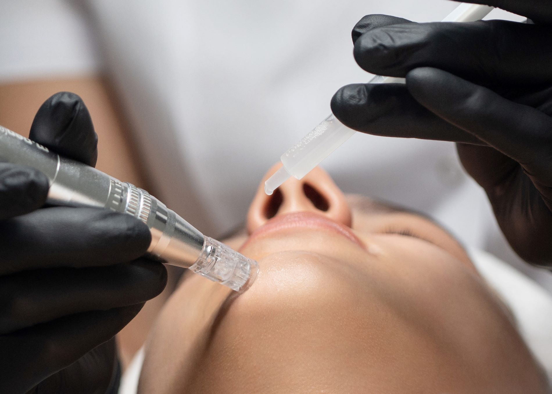studio-style-microneedling-002