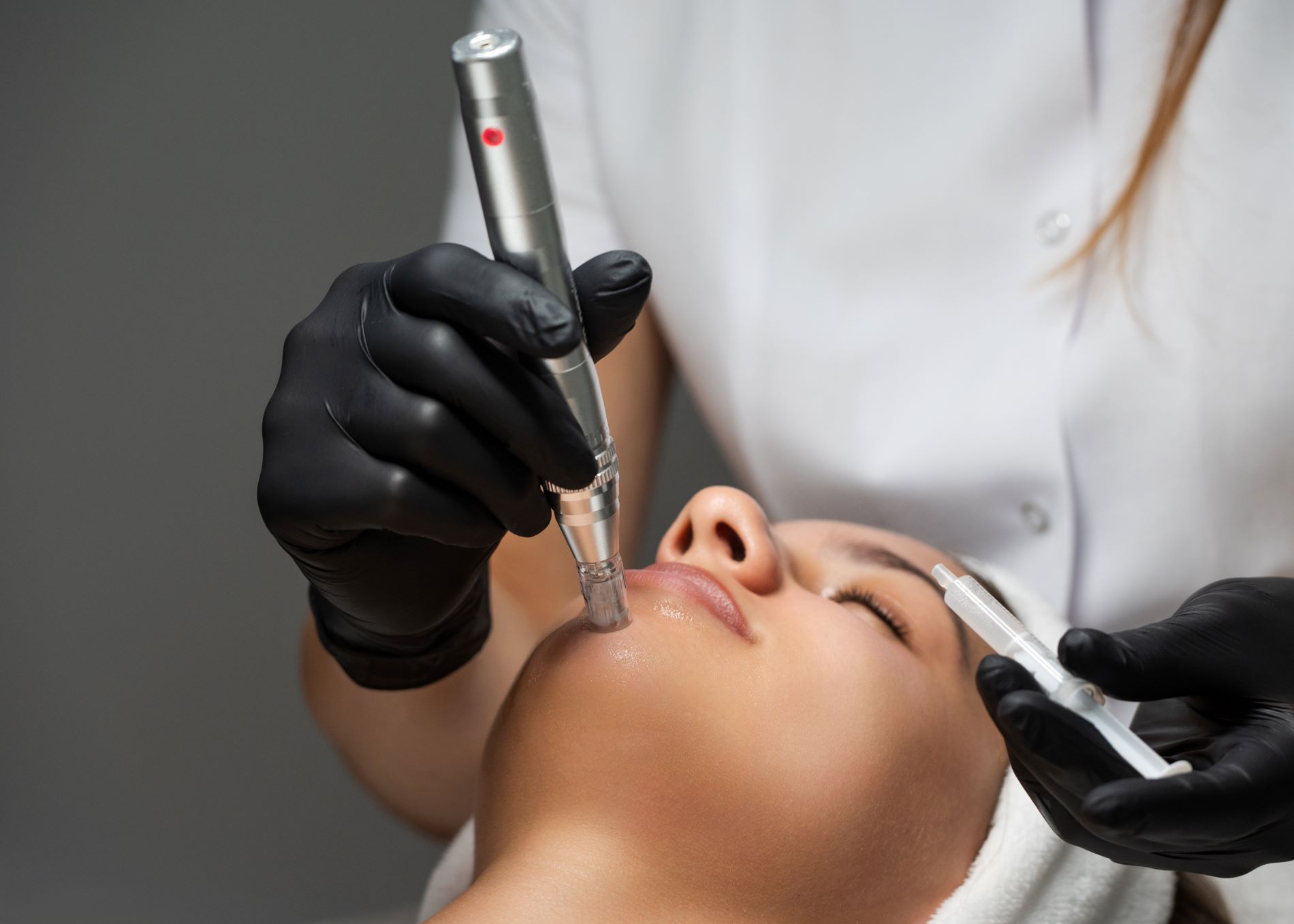 studio-style-microneedling-003