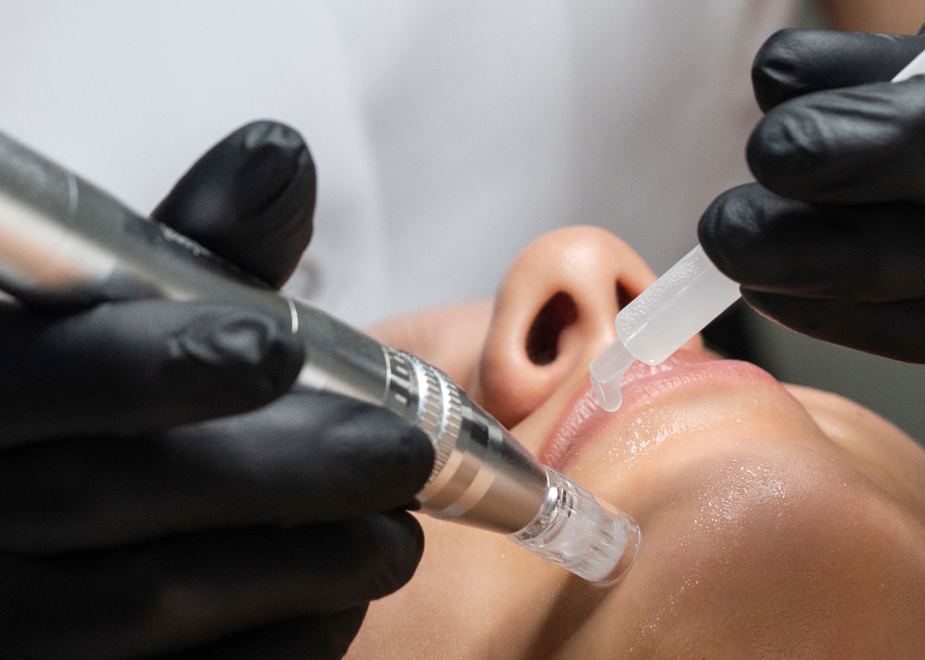 studio-style-microneedling-004